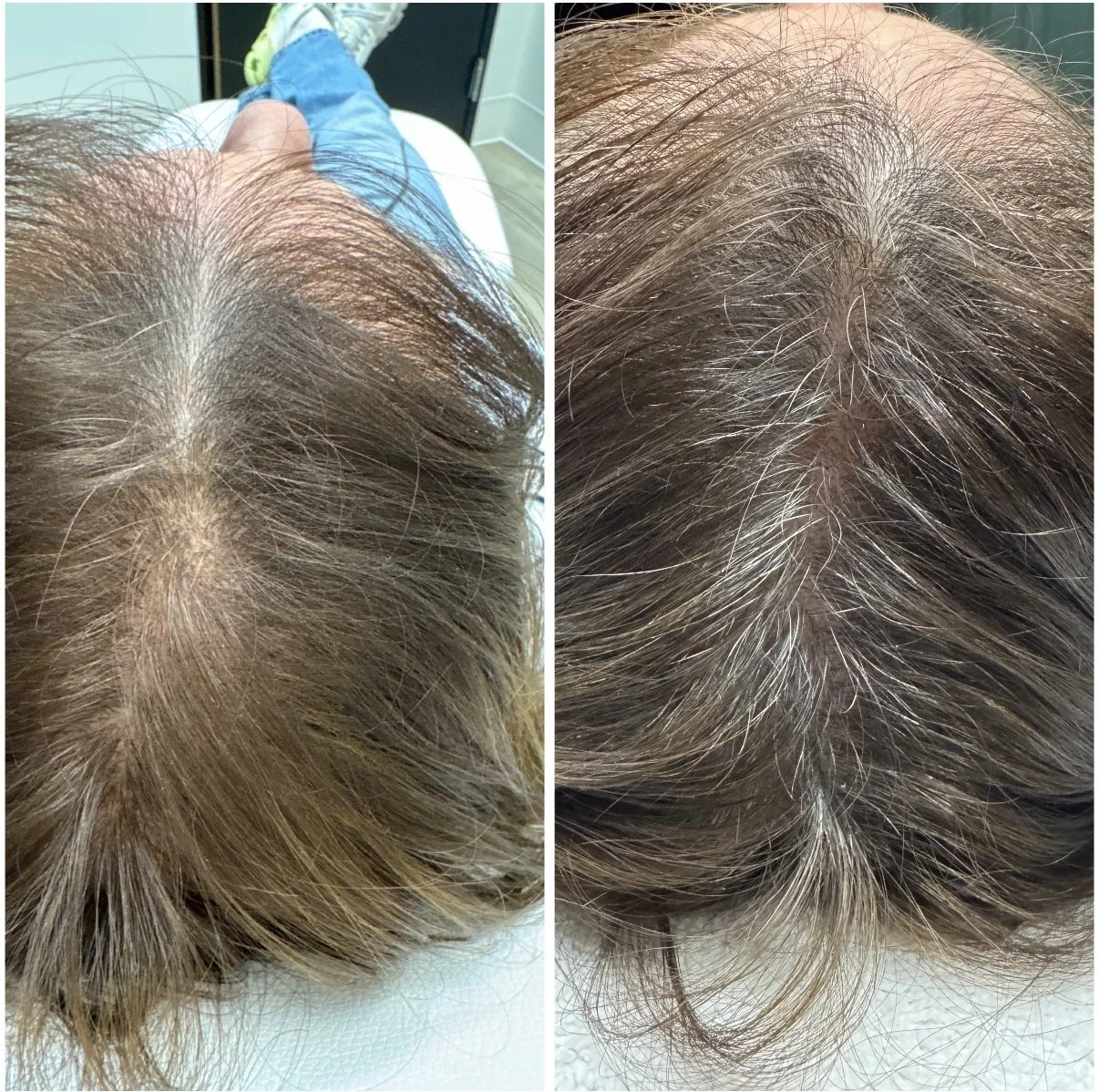 Close-up of a person's scalp showing hair before and after a hair treatment or hair coloring process.