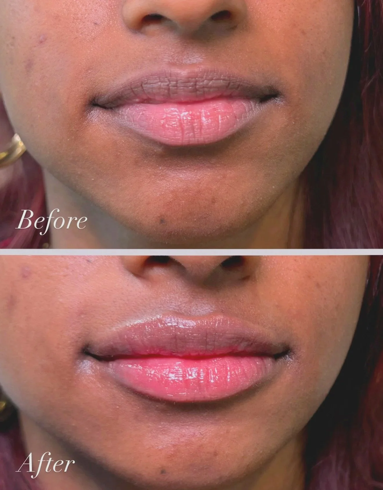 Close-up of a person's lips before and after a lip gloss application, showing smoother, glossier lips in the after image.