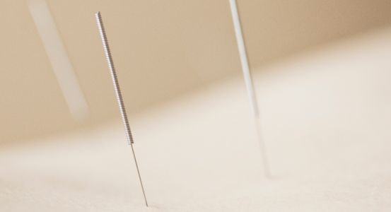 image of acupuncture needles