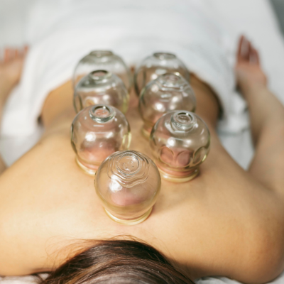 cupping on back image