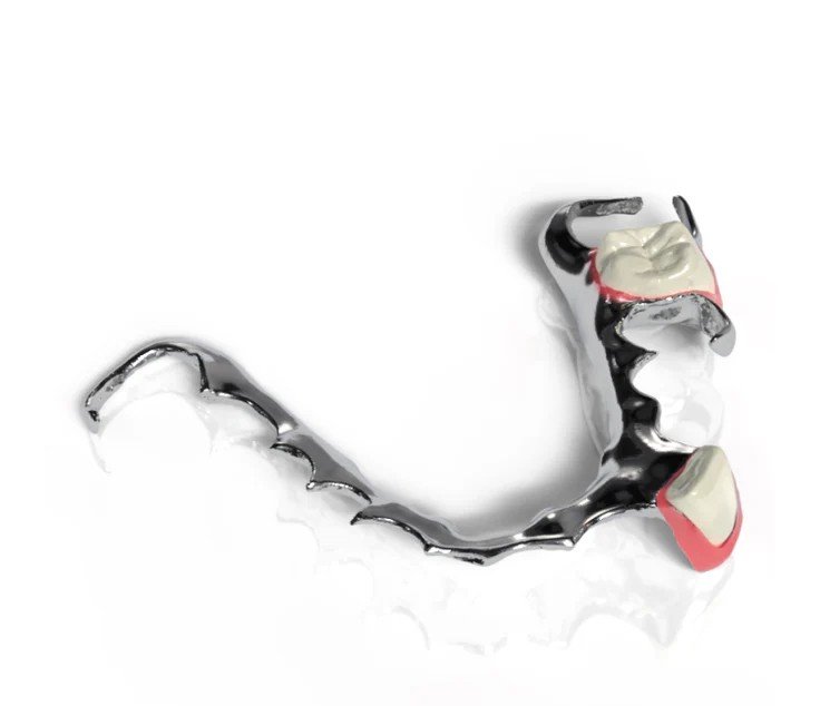 PARTIAL DENTURES TITANIUM FRAMEWORK