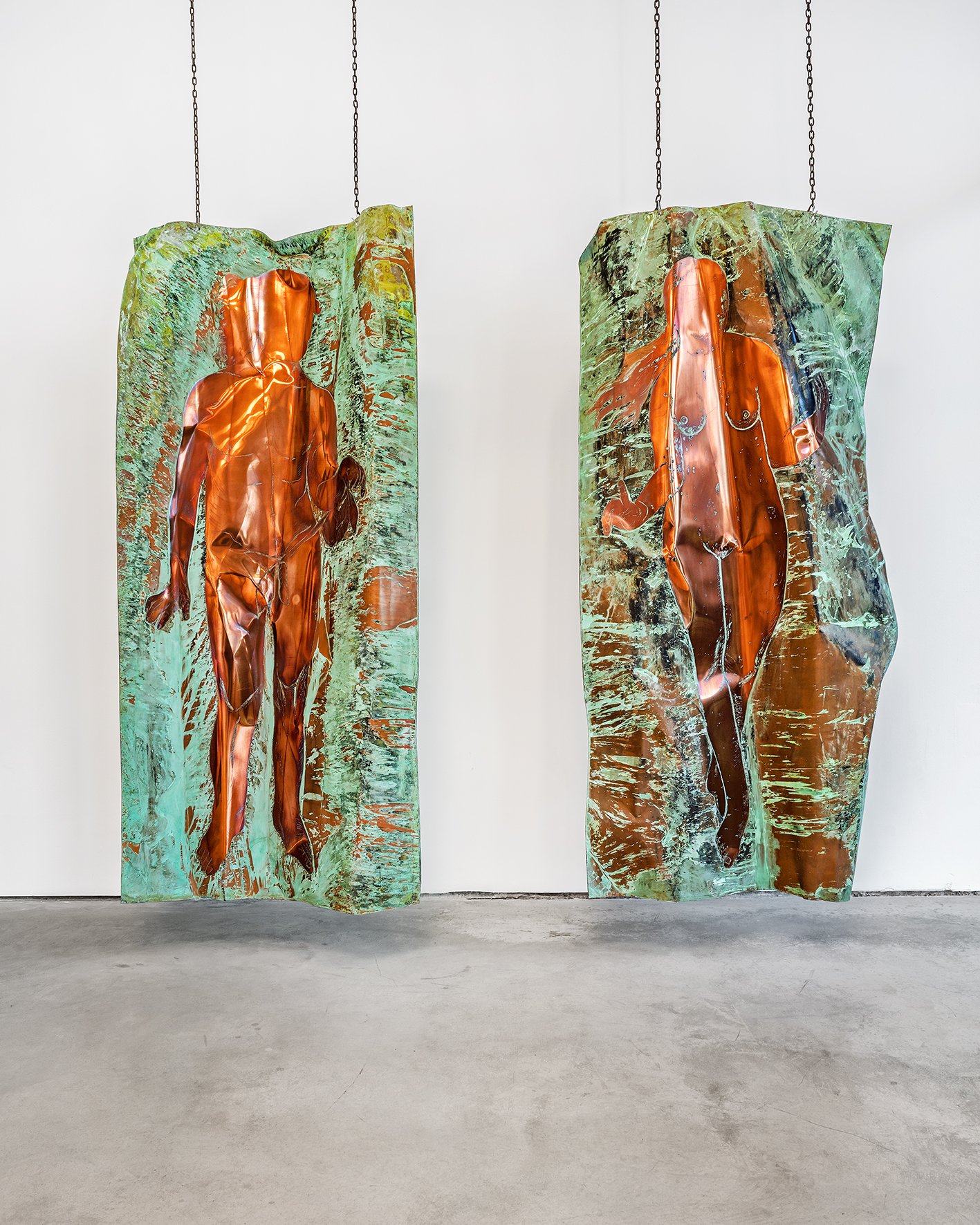 Open Bite Series: Adam and Eve III