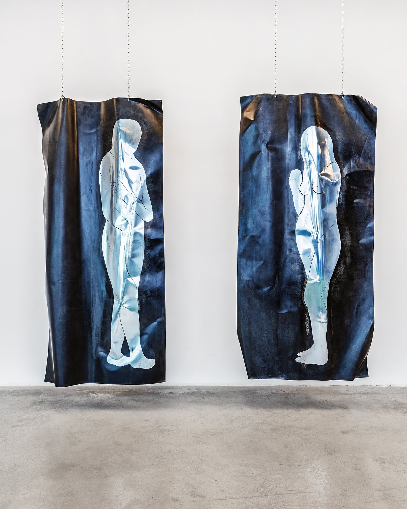 Open Bite Series: Adam and Eve IV