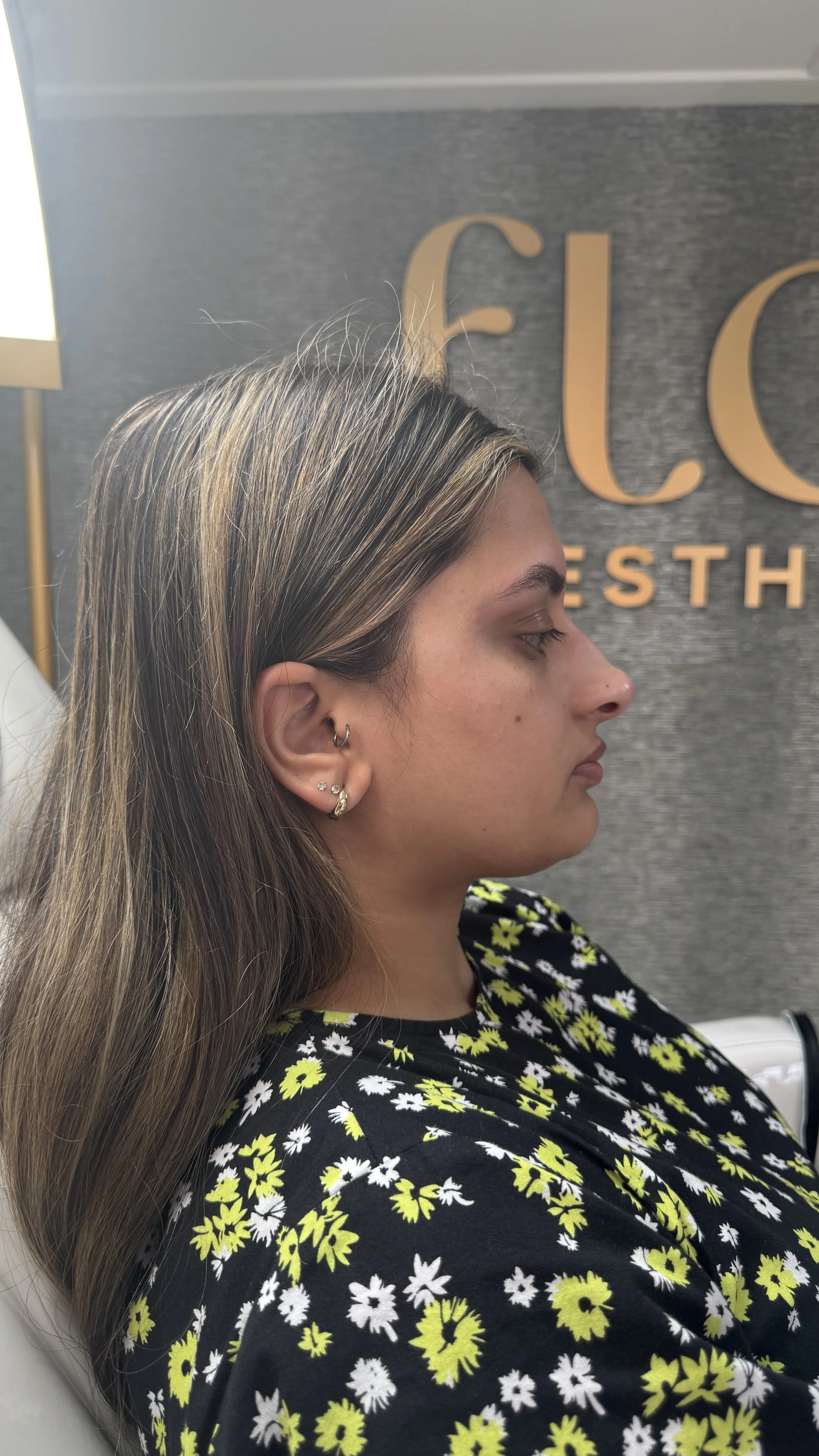 Side profile of a young woman with long brown hair, sitting in front of a textured gray wall with large partially visible with the word 'ELOS' in gold letters. She is wearing a black shirt with yellow and white floral patterns.