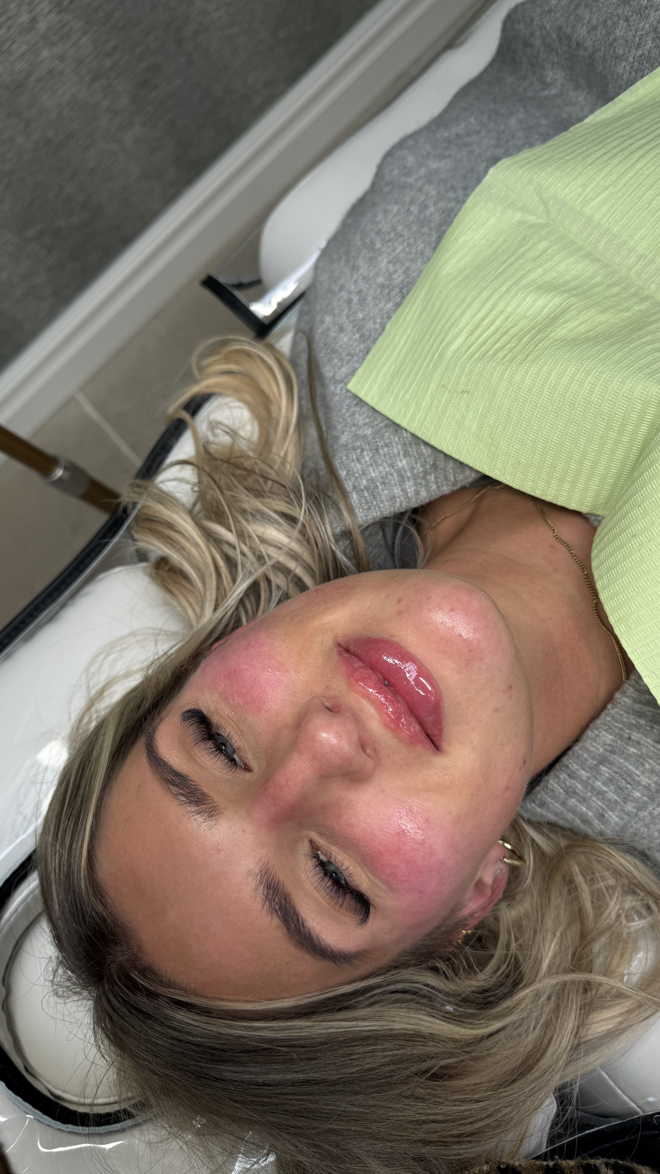 Close-up of a woman with blond hair lying on a dental chair, partially covered with a green dental bib, with shiny lips and eyes closed.