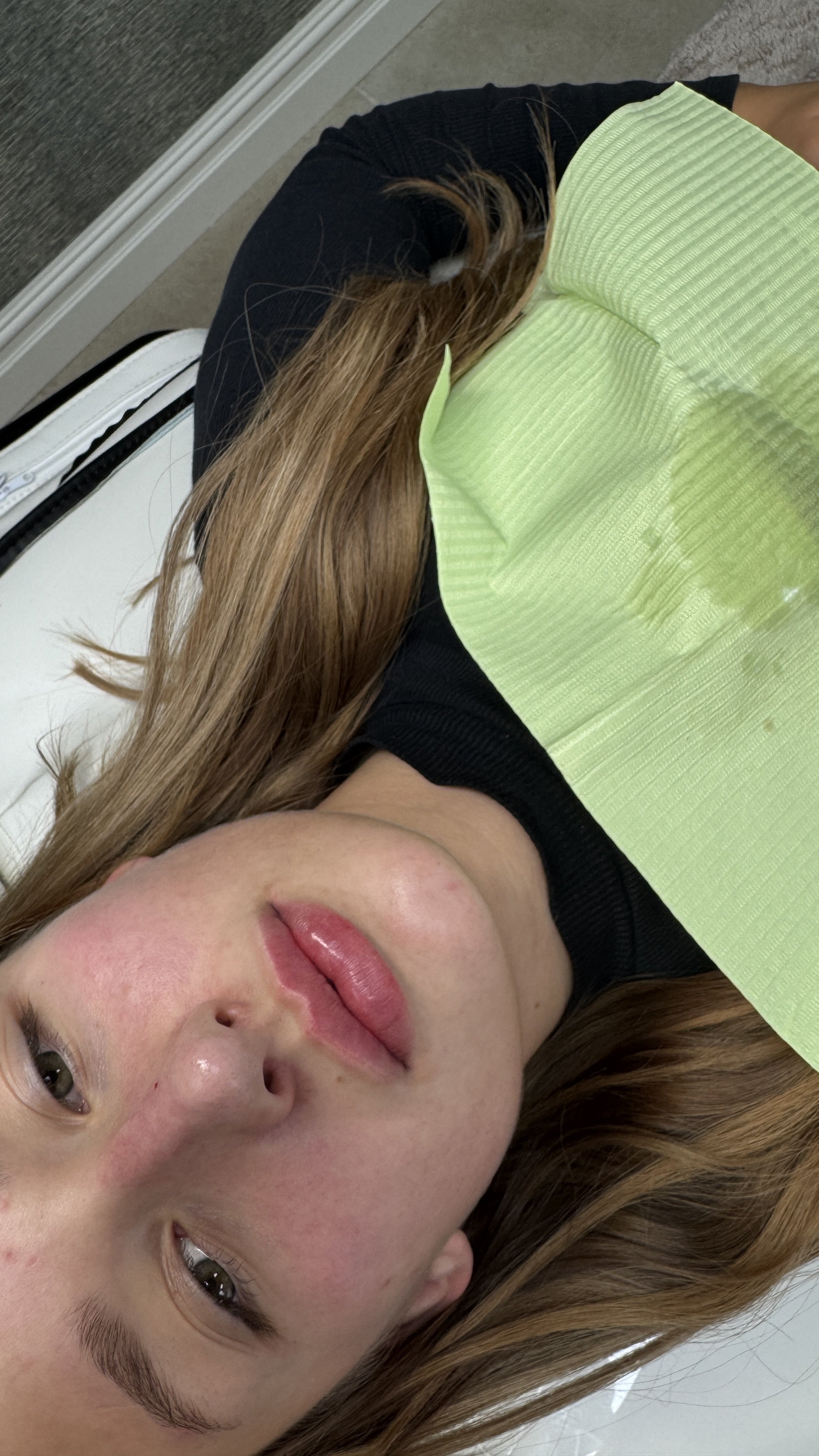 A young woman with long auburn hair lying down with her head resting on a green pillow, wearing a black shirt and a green disposable bib.