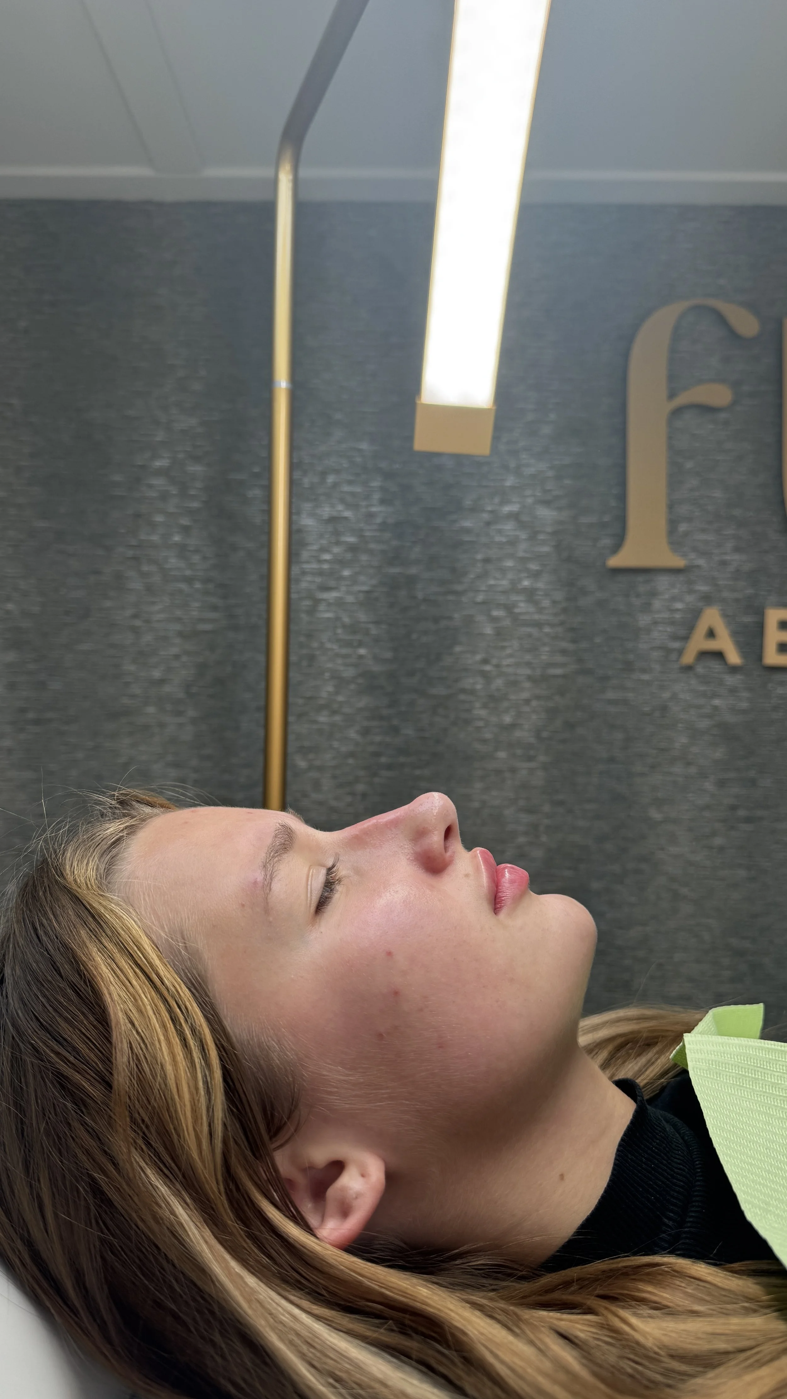 A young woman with blonde hair lying down with her eyes closed in a medical or dental office. She has some acne on her face and is wearing a dark shirt with a green bib or cover.