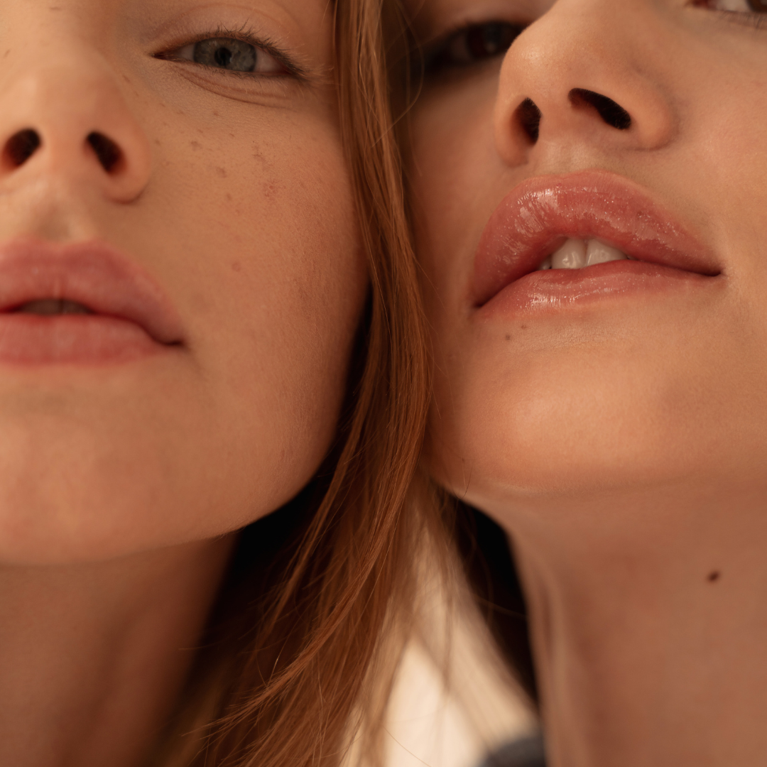 Close-up of two women's faces, focusing on their noses and lips, with one woman slightly biting her lip and both with light skin and natural makeup.