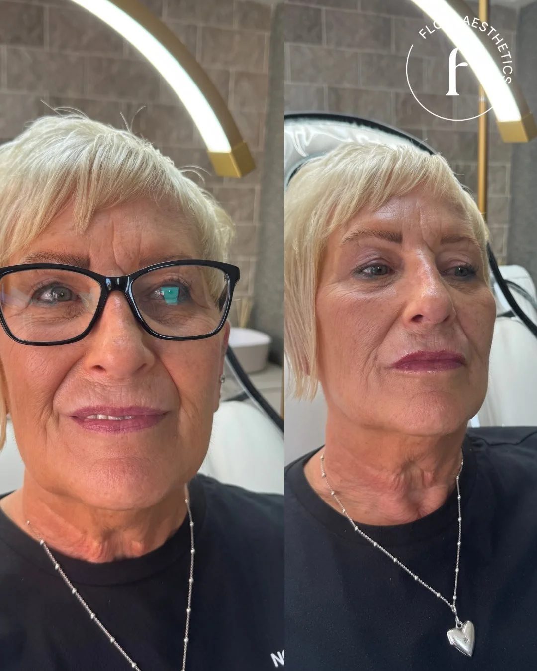 Before and after photos of a woman in a salon, showing her head and shoulders. The woman has short blond hair, wears glasses in the first photo, no glasses in the second, and is wearing a black shirt and a silver heart necklace. The background featur