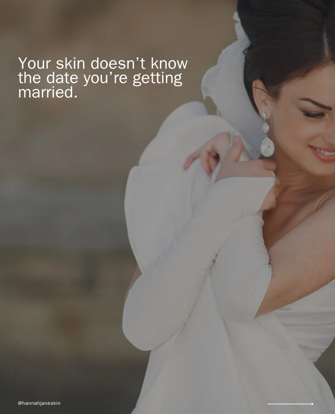 Your skin doesn&rsquo;t know the date you&rsquo;re getting married. Real skin concerns take time and planning, so start about 12 months before and cut the guesswork. 

DM me your skin struggles!

📍 Exmouth, Devon, UK
⭐ Advanced Skin Health Specialis