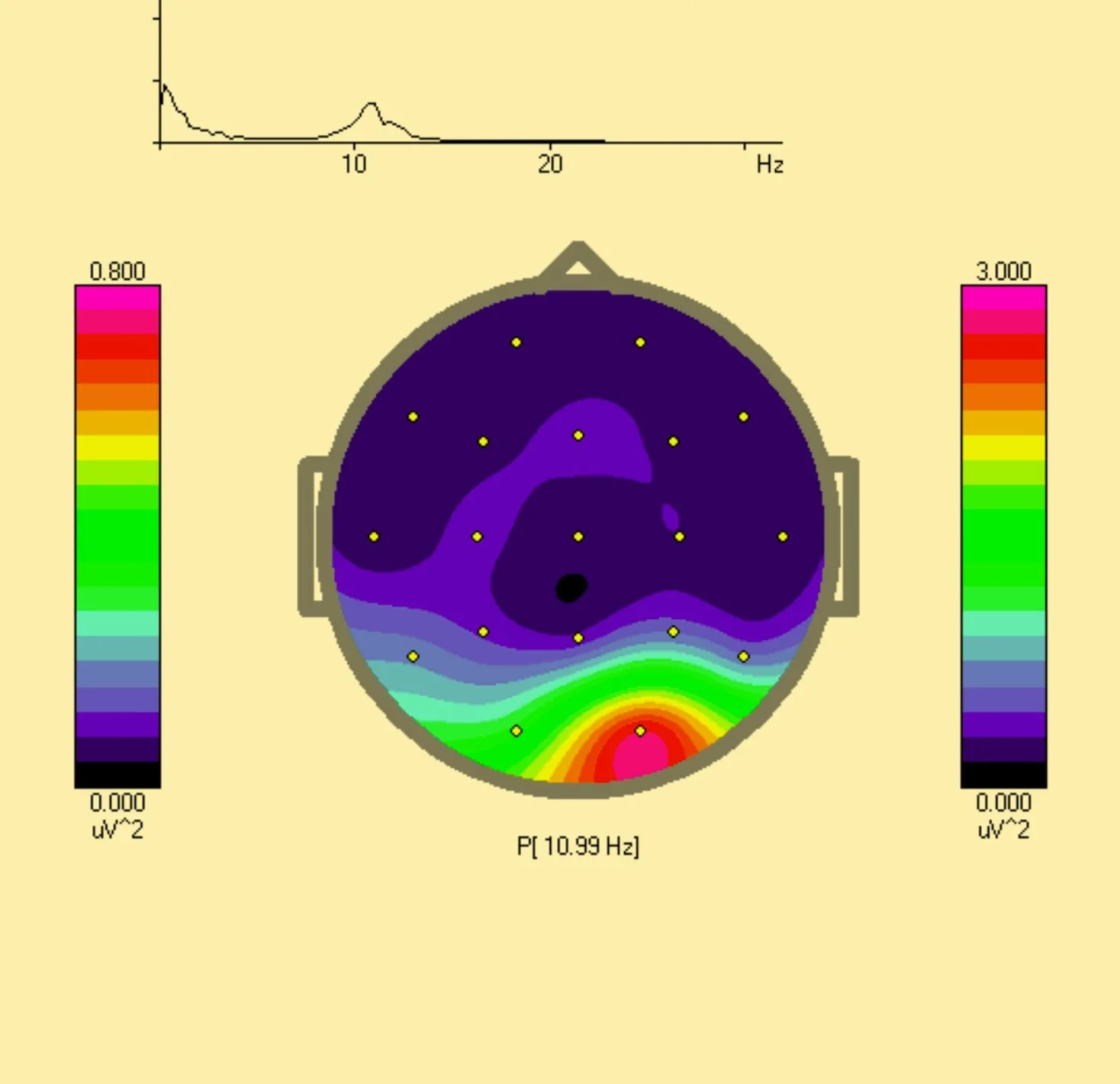 Brain topographic map showing electrical activity at 10.99 Hz, with colored scale bars for power levels in microvolts squared. A frequency spectrum graph is displayed above.