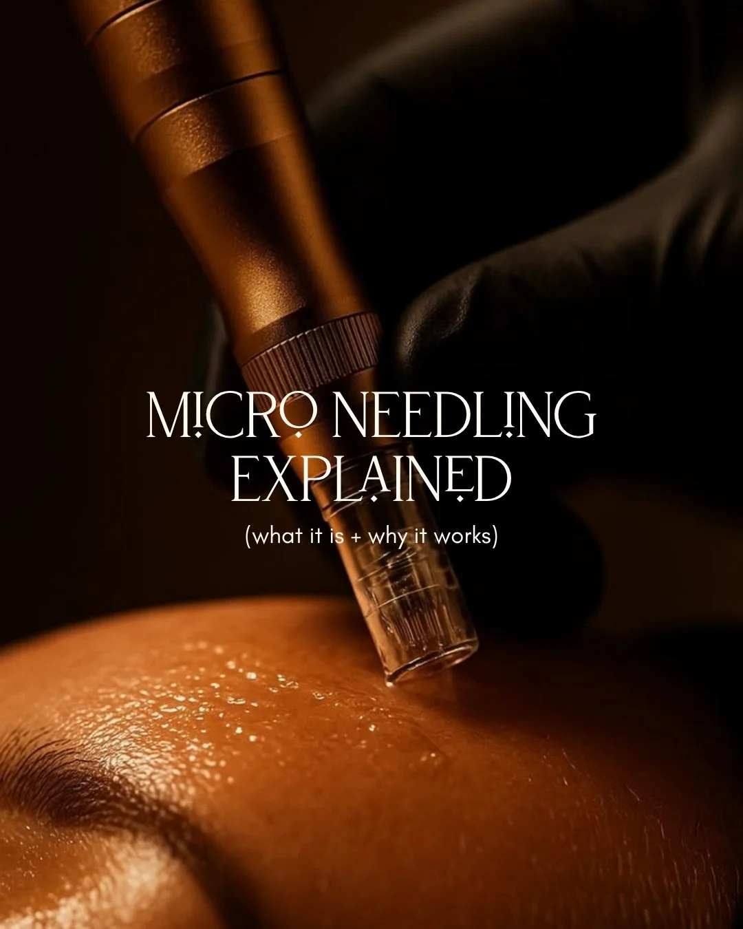 There&rsquo;s a point where surface level treatments stop being enough.
Where your skin isn&rsquo;t needing more product...it&rsquo;s needing support at a deeper level.

Microneedling works in that space by encouraging the skin to return to what it a