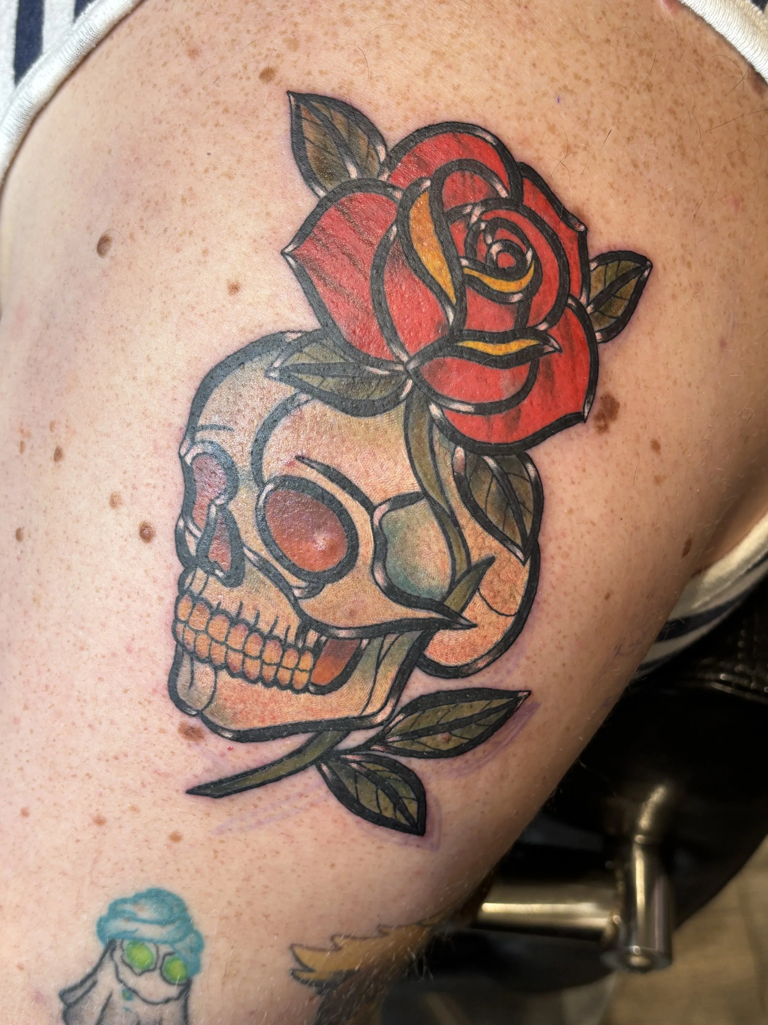 Tattooing Around Moles and Freckles: What You Need to Know