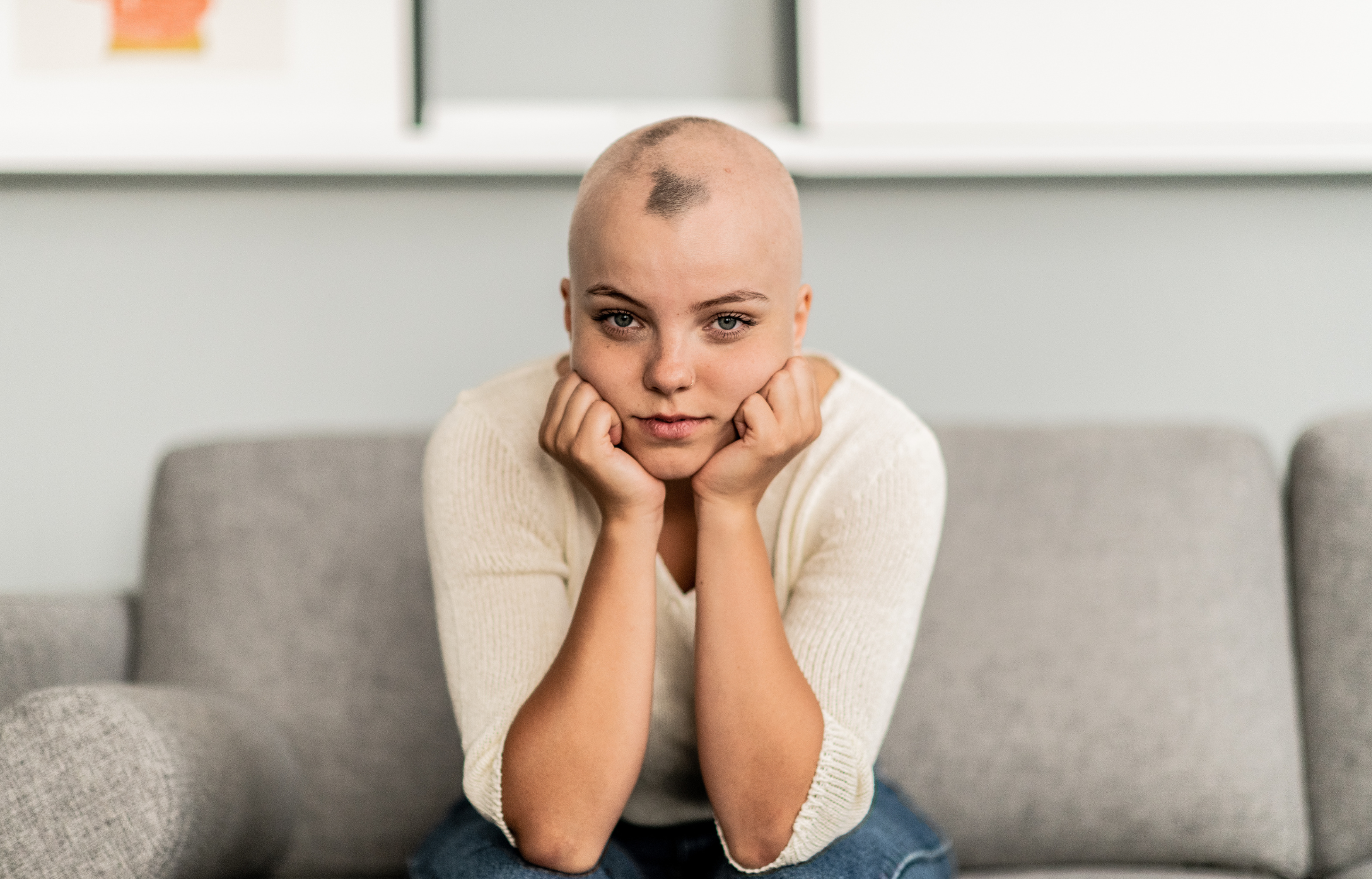 Alopecia vs. Balding: How to Know the Difference and What Treatment Options Are Available