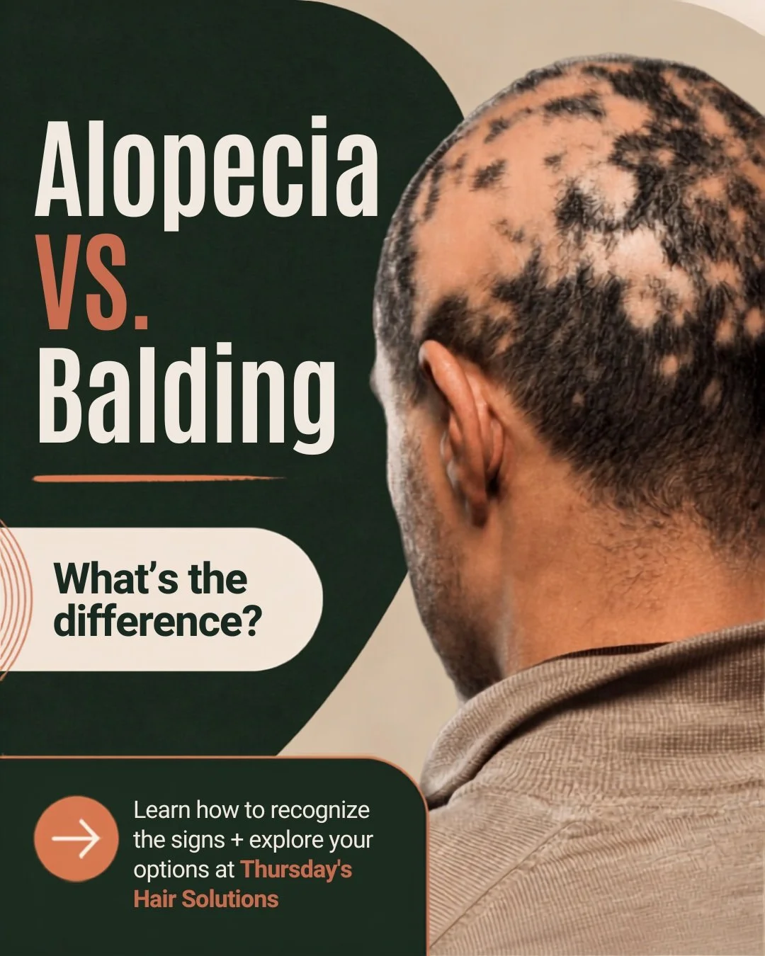 Is it alopecia, balding, or simply thinning hair? 🤔

Not all hair loss looks the same, and understanding what you're experiencing can be the first step toward finding the right solution.

For Alopecia Awareness Month, we're breaking down alopecia vs