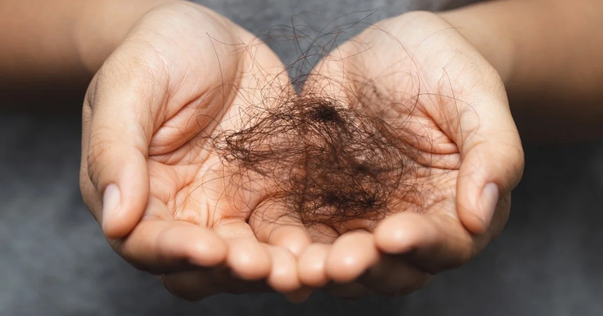 A closeup on a woman's hands clasped together. She is holding a clump of black hair that has fallen out of her head.