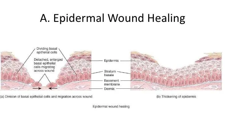 epidermal+wound+healing.jpg