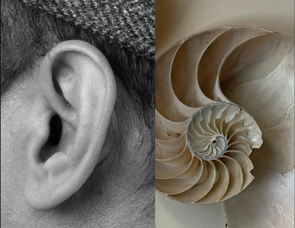 Personalised Care for People Living with Hearing Loss