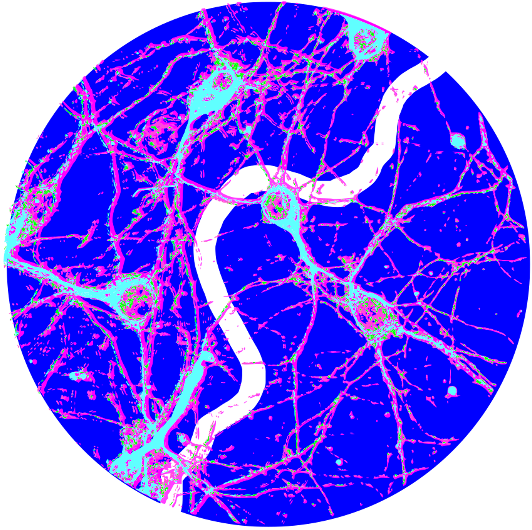 Colorized image of a human brain scan showing neural pathways with bright pink, green, and blue highlights.