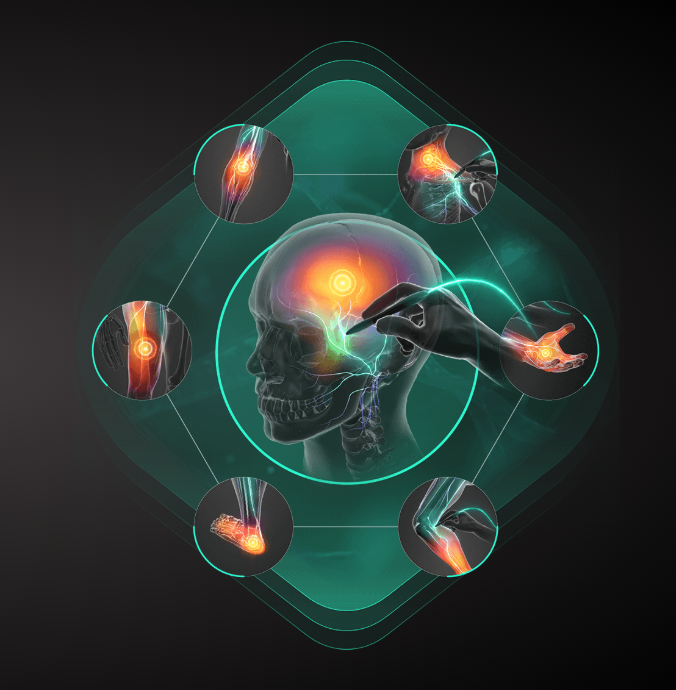 What Is Stimpod? A New Approach to Nerve Pain Relief at Arancia Physical Therapy