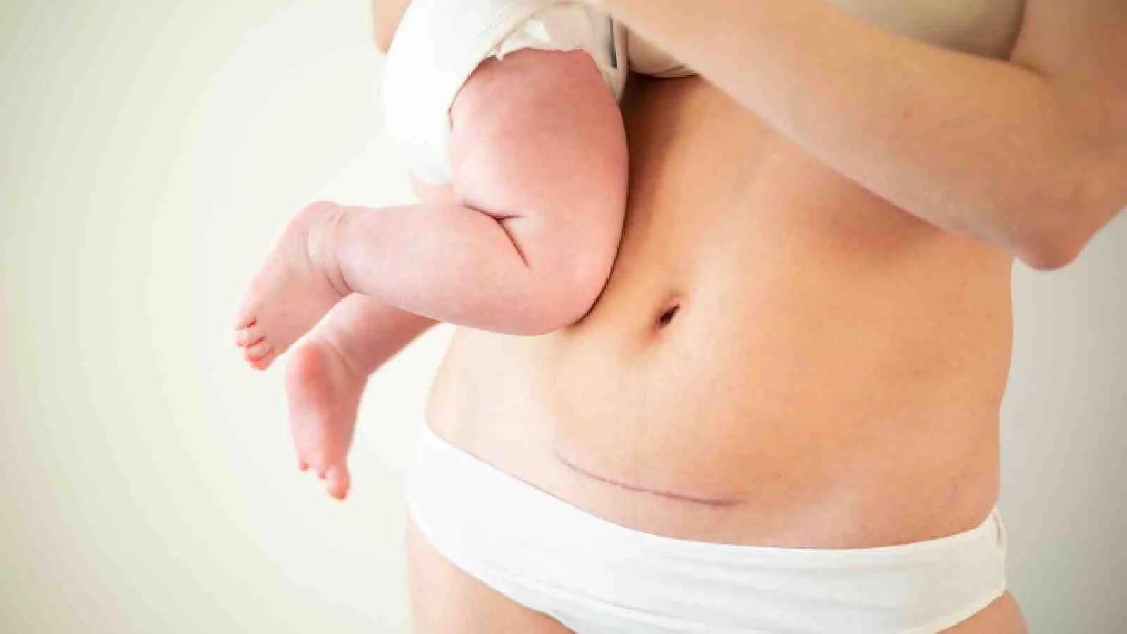 Why Your Bladder Hasn’t Felt the Same Since Your C-Section