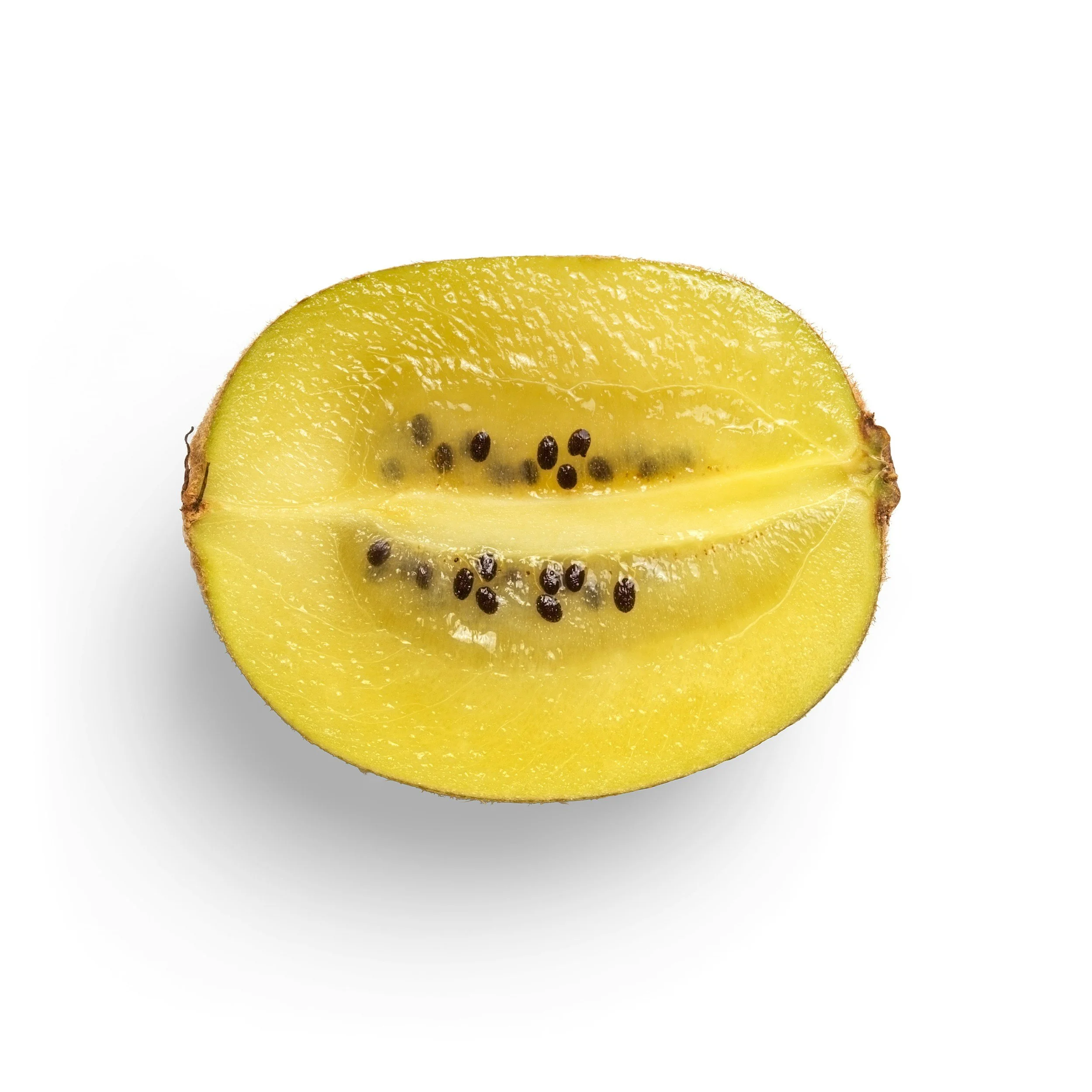 Kiwi: o pequeno fruto com grandes benefícios