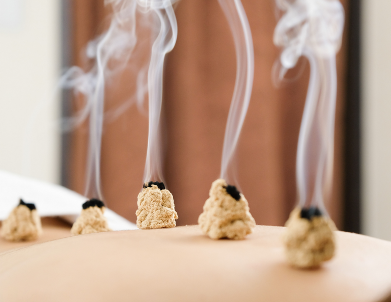 Moxibustion.png