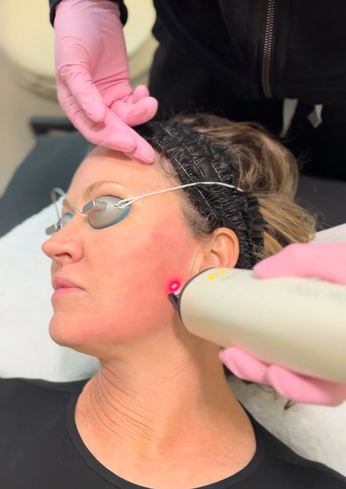 Collagen stimulating laser is 205 off