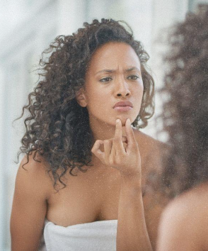 The Real Reason Adult Acne Keeps Coming Back: How to Decode the Patterns Behind Your Breakouts And Finally Treat Them Effectively