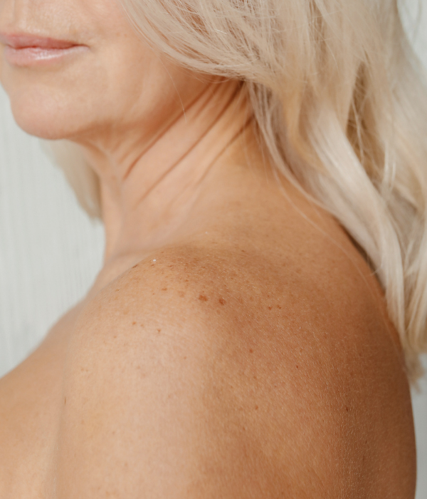 The Invisibility of Perimenopause