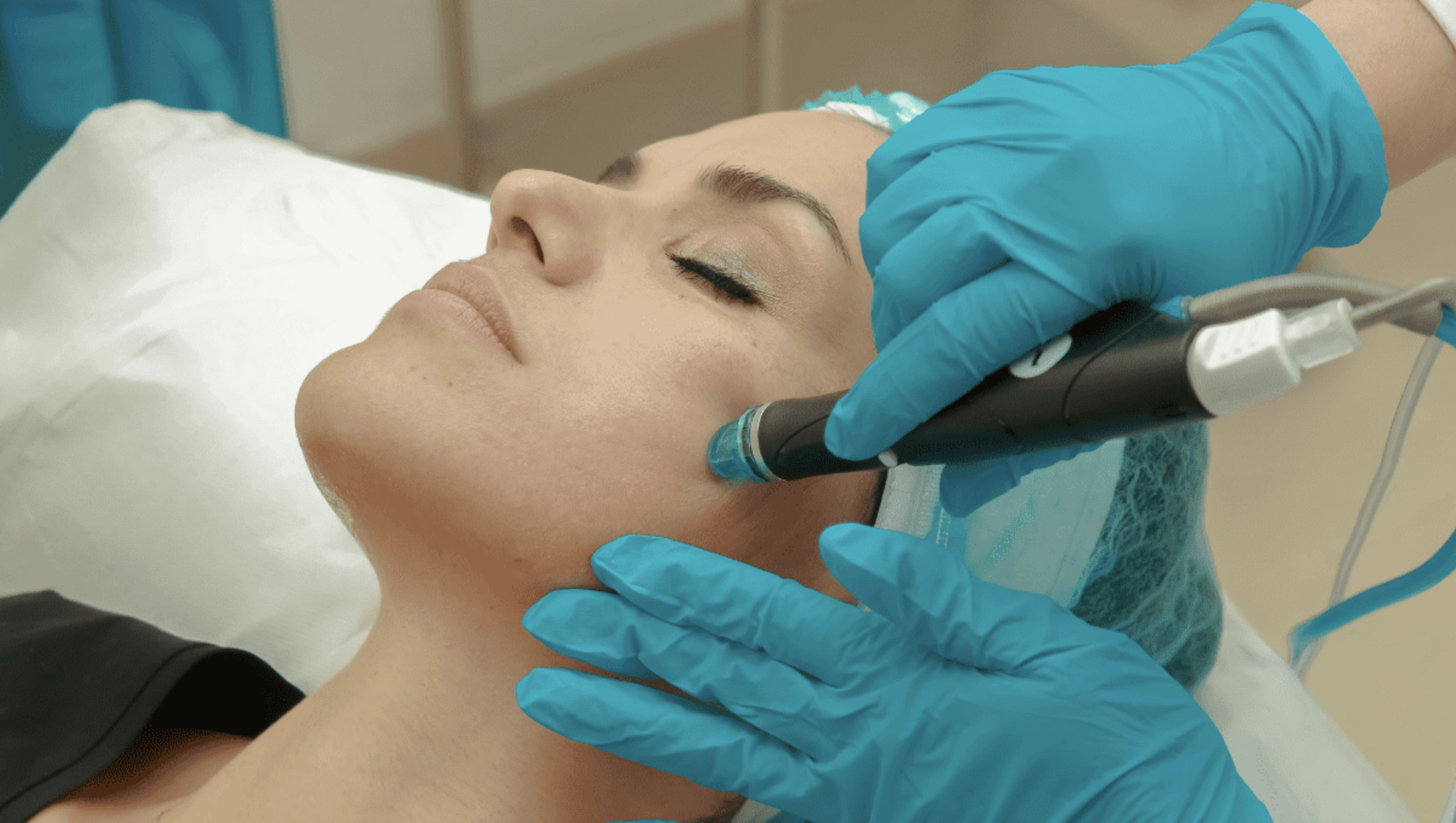 Understanding the Aerolase Neo Laser: A Revolutionary Skin Treatment Solution