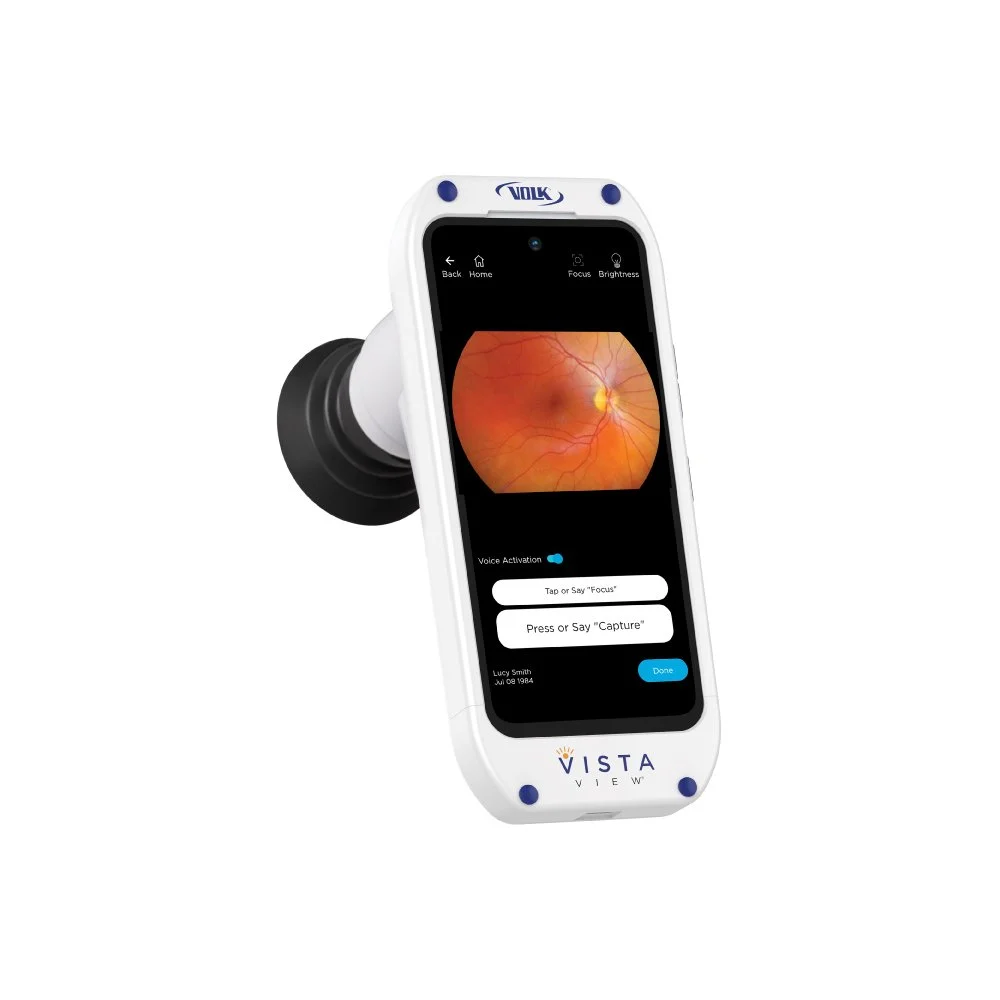 VistaView™ Mydriatic Portable Fundus Camera
