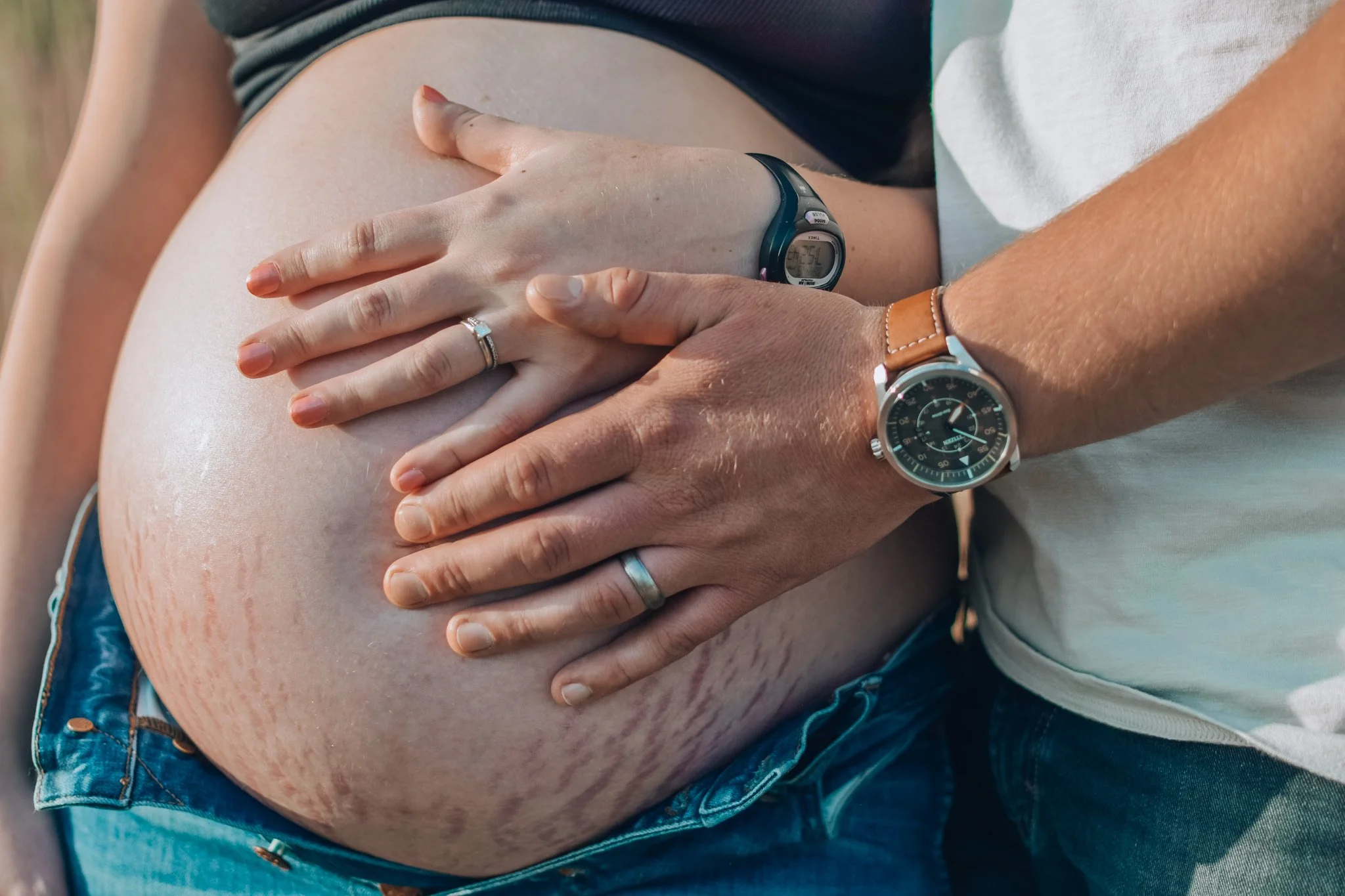 Close-up of pregnant woman with stretch marks on belly, being gently held by partner's hands, both wearing watches, outdoor setting.