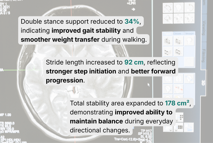 Movement summary visualization for neurology wellness and follow-up conversations