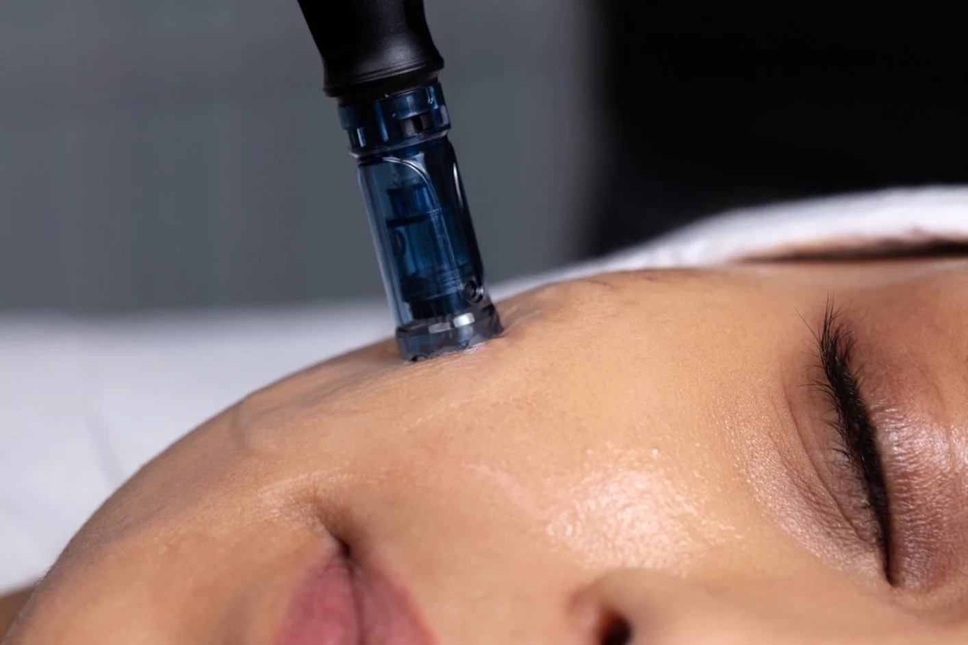 beautylab-launches-new-microneedling-pen-system.jpeg