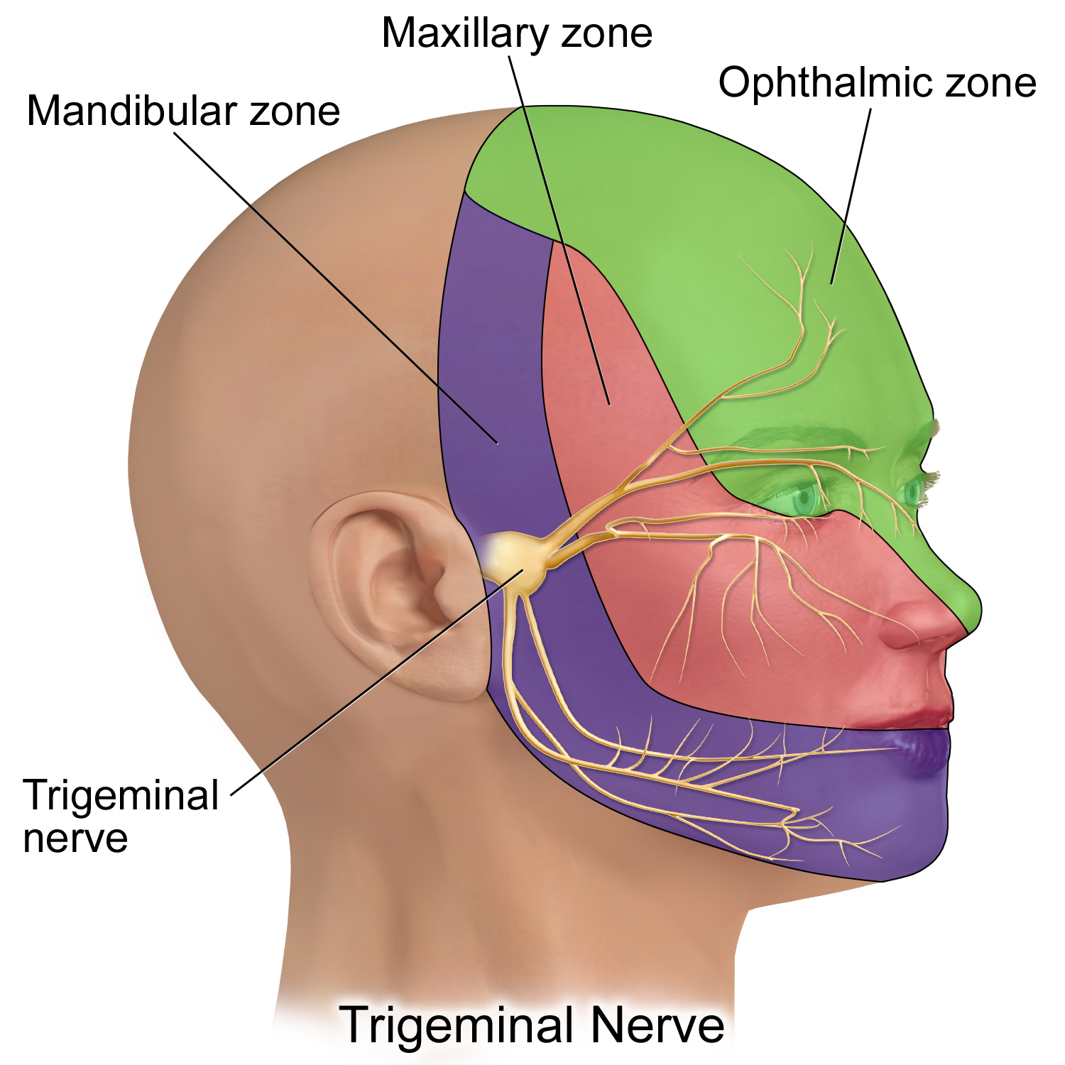 Trigeminal nerve dermatomes involved in migraines