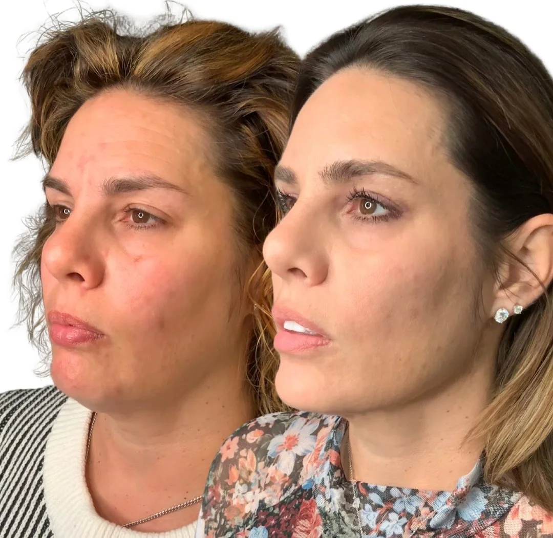 November Spotlight 🤩
When you trust our expertise + services, we deliver results!

Consistency is key &mdash; you don&rsquo;t workout once and expect abs, right? Same concept goes for aesthetic + wellness treatments!