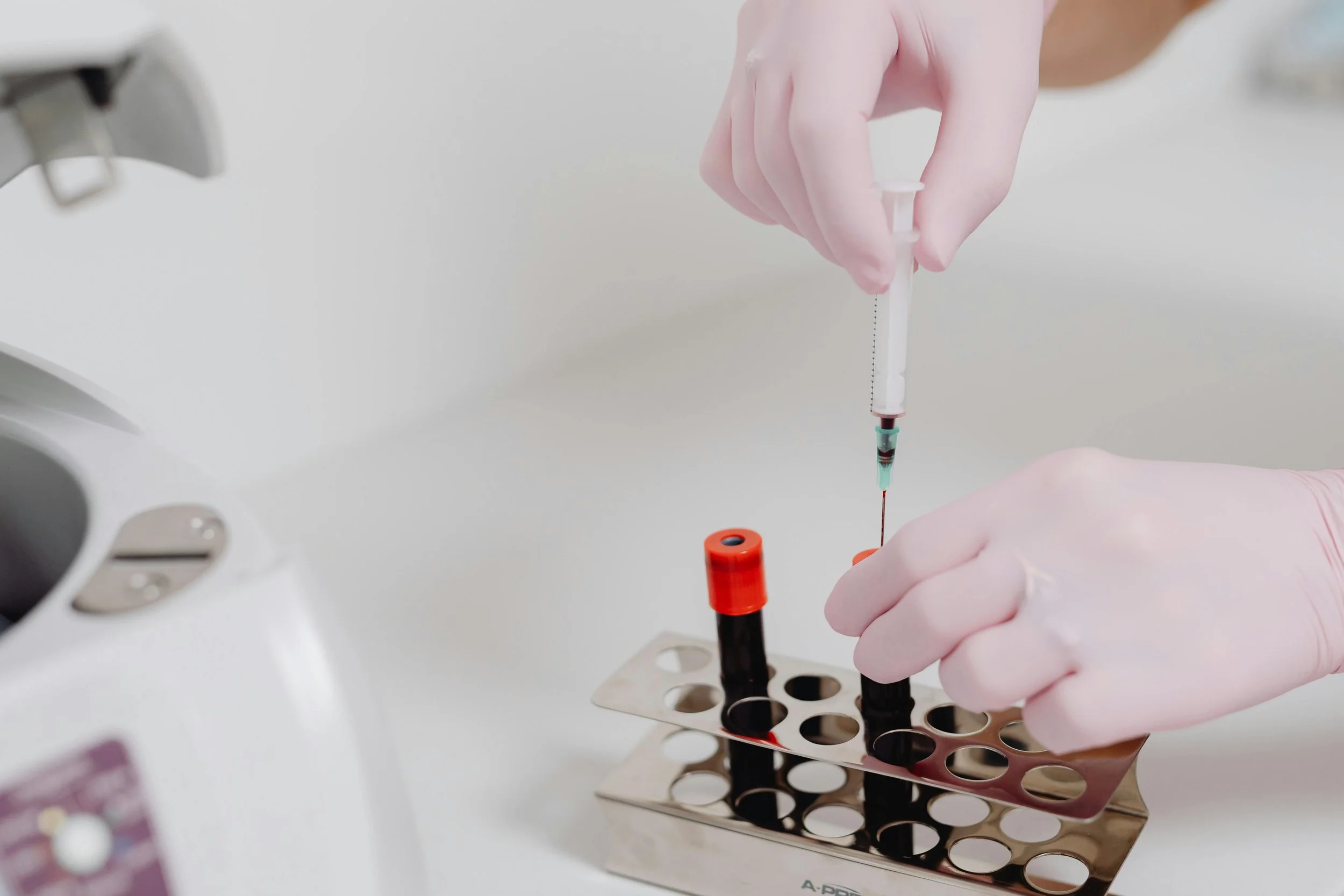 PRP en traumatología en Barcelona: qué es, beneficios y cuándo te lo recomendamos