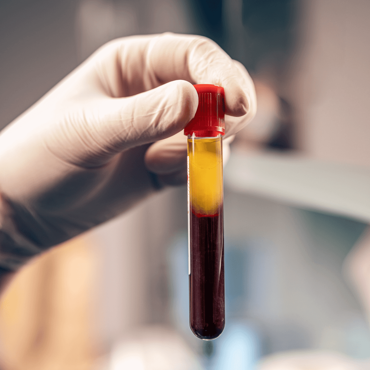 prf p shot erectile dysfunction treatment