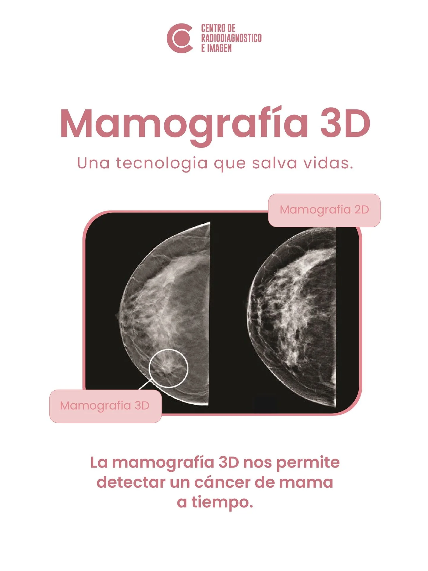 La mamograf&iacute;a 3D ofrece im&aacute;genes m&aacute;s detalladas para una detecci&oacute;n temprana.

👉🏼81 1734 2030 / 81 8333 4185 📍Hidalgo 2315 Col. Obispado Mty, N.L