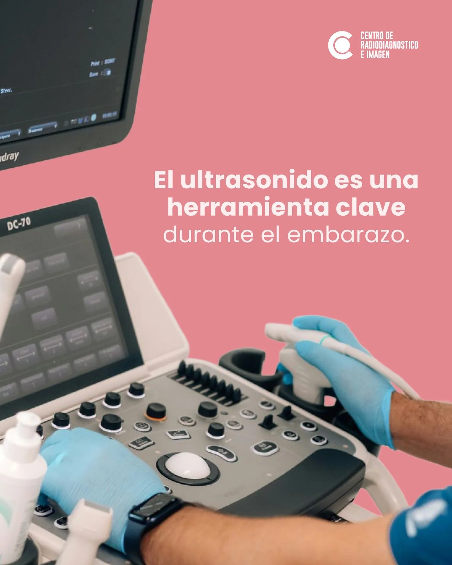 El ultrasonido es una herramienta fundamental durante el embarazo.
Con este estudio es posible:
&bull; Dar seguimiento al crecimiento y bienestar del beb&eacute;
&bull; Detectar posibles complicaciones a tiempo
&bull; Acompa&ntilde;ar cada etapa con 