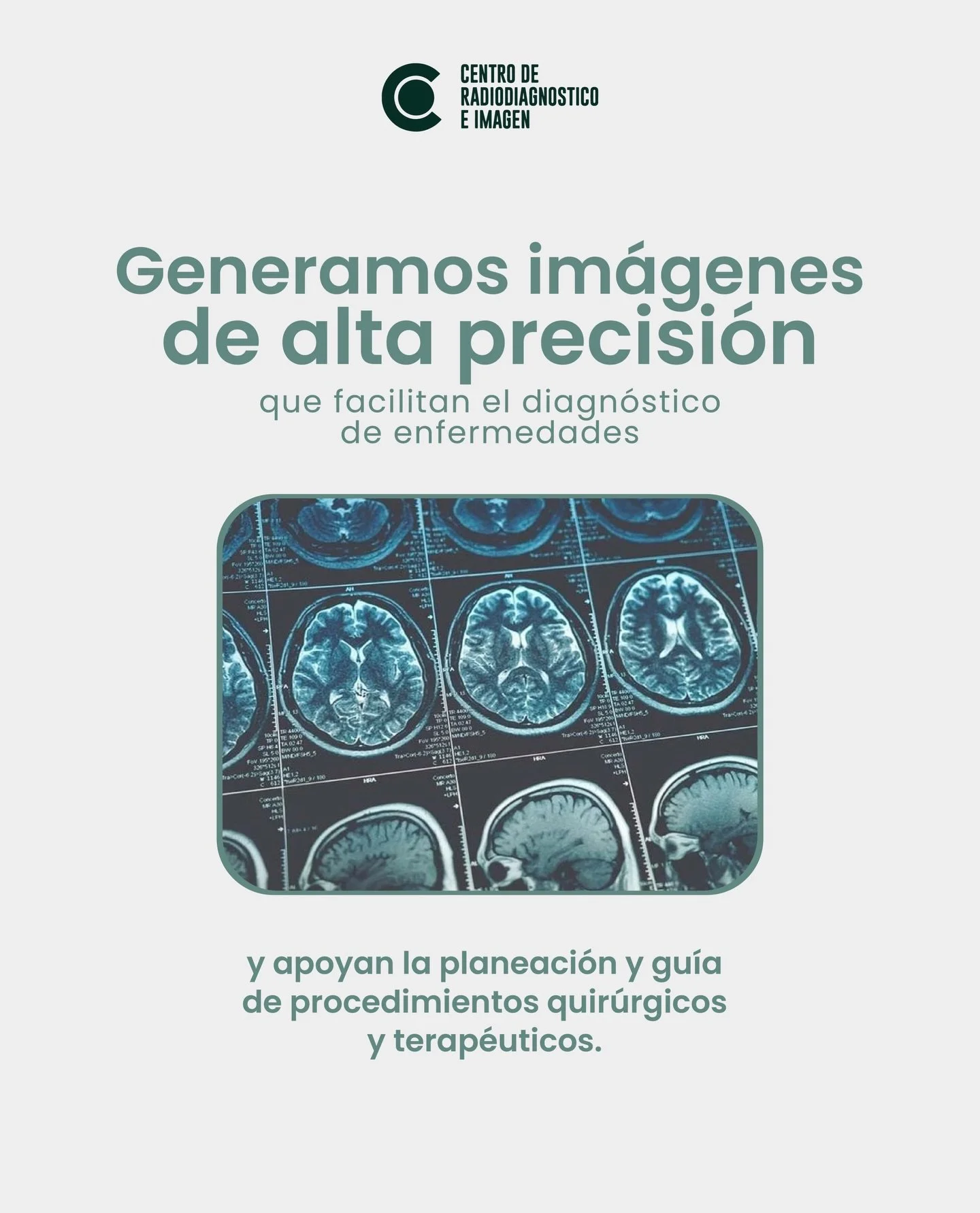Generamos im&aacute;genes de alta precisi&oacute;n que facilitan el diagn&oacute;stico oportuno y respaldan la planeaci&oacute;n de procedimientos quir&uacute;rgicos y terap&eacute;uticos.

👉🏼81 1734 2030 / 81 8333 4185 📍Hidalgo 2315 Col. Obispado