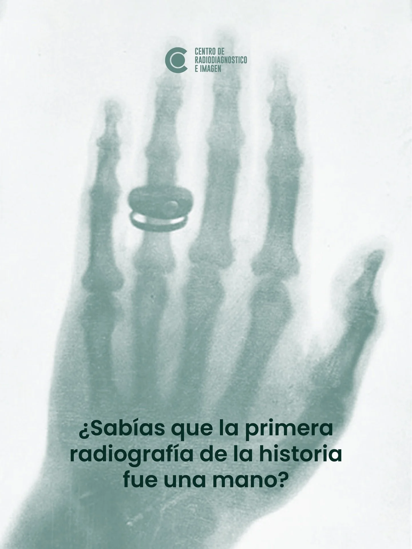 &iquest;Sab&iacute;as que la primera radiograf&iacute;a fue una mano?

En 1895, R&ouml;ntgen mostr&oacute; por primera vez el interior del cuerpo sin cirug&iacute;a.

As&iacute; naci&oacute; la radiolog&iacute;a moderna.
👉🏼81 1734 2030 / 81 8333 41