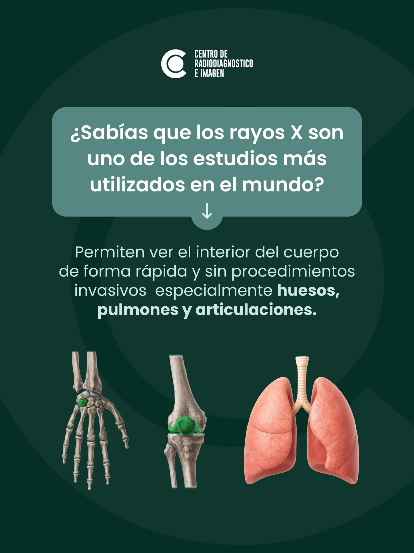 &iquest;Sab&iacute;as que los rayos X son uno de los estudios m&aacute;s utilizados en el mundo?

Permiten ver el interior del cuerpo de forma r&aacute;pida y sin procedimientos invasivos.

Se utilizan para detectar fracturas, infecciones y problemas