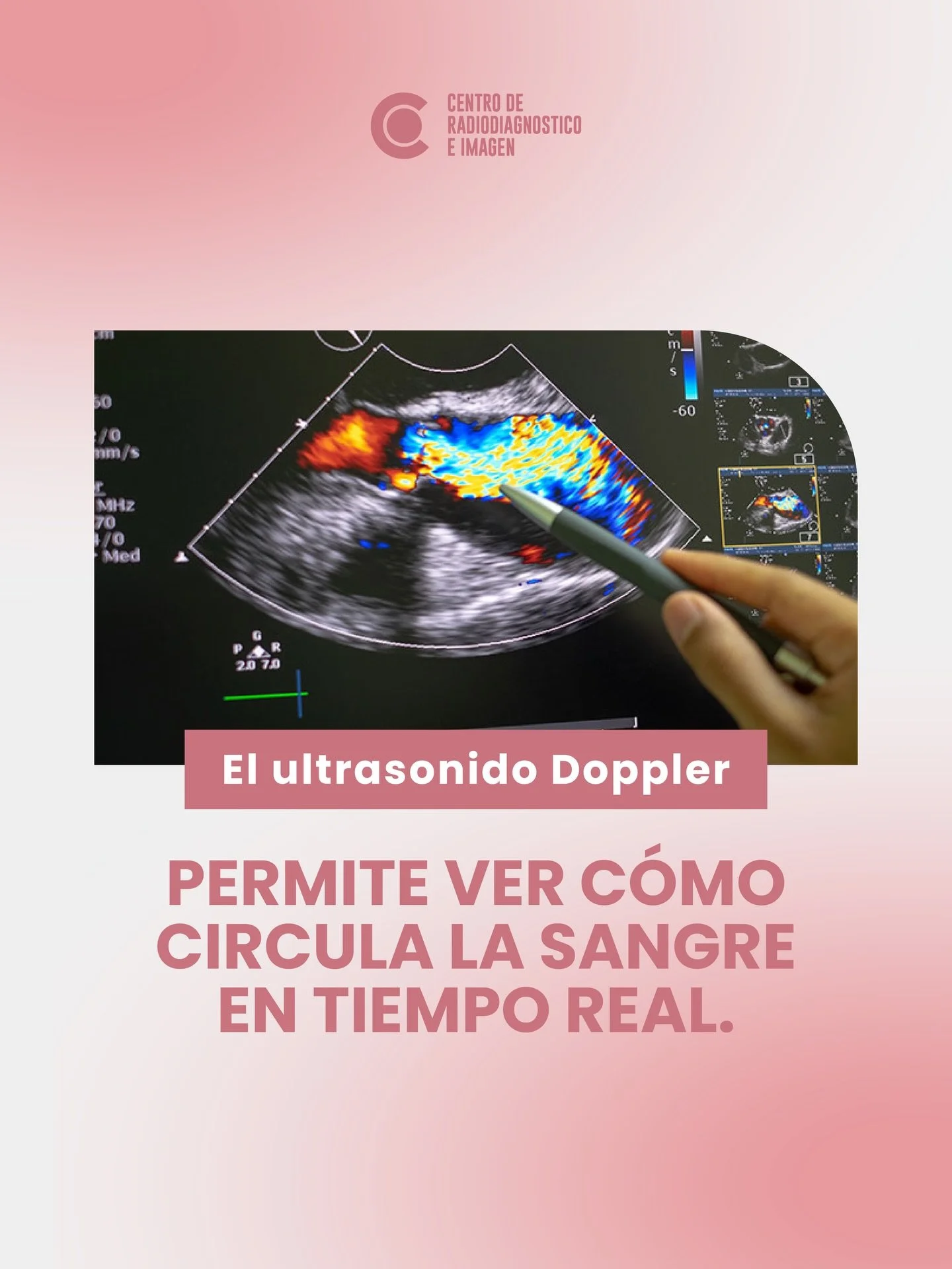 &iquest;Te pidieron un estudio Doppler?

En CDR contamos con equipo especializado para analizar el flujo sangu&iacute;neo con alta precisi&oacute;n.

&iexcl;Ac&eacute;rcate con nosotros!
👉🏼81 1734 2030 / 81 8333 4185 📍Hidalgo 2315 Col. Obispado Mt