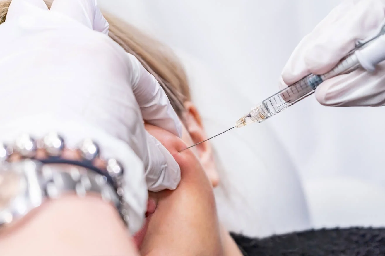 Level 3 Dermal Fillers (Cannula)