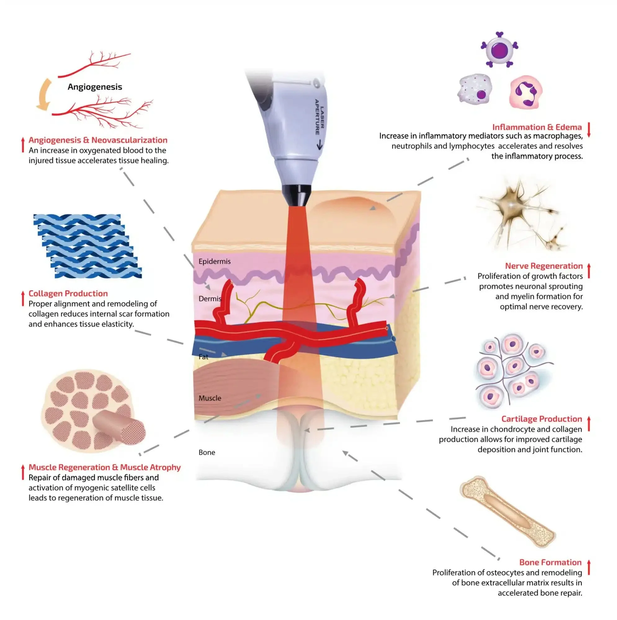 Diagram showing laser treatment on skin, illustrating processes of angiogenesis, collagen production, muscle regeneration, inflammation, nerve regeneration, cartilage production, and bone formation for tissue healing and regeneration. Reduces pain