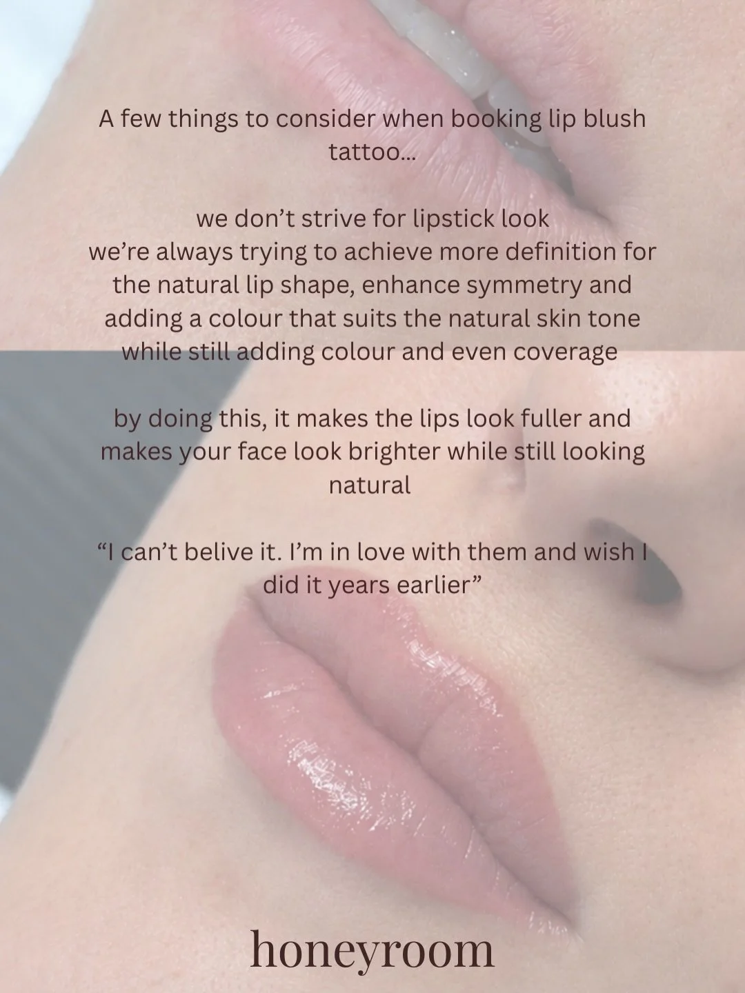 For the pout of a lifetime