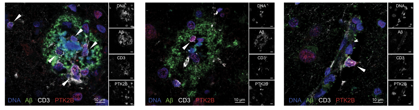 Comment on New Multiomic Atlas to Decode the Brain’s Blood Vessels posted on ALZFORUM