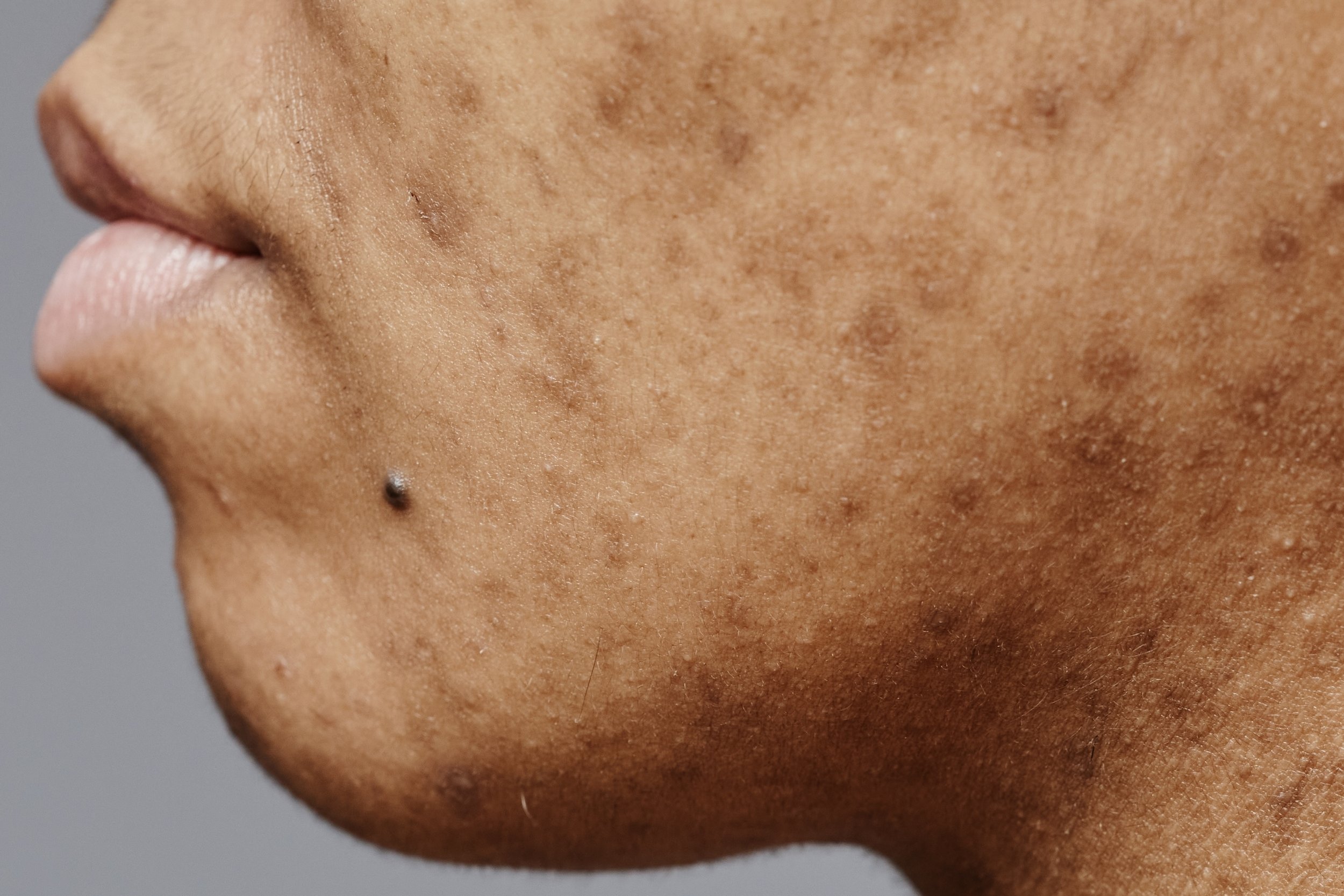 PIHP Leonie Thorne Skin Studio Southampton